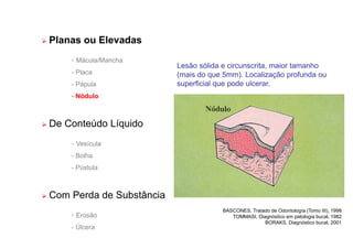 Planas ou Elevadas
- Mácula/Mancha
- Placa
- Pápula
- Nódulo
 De Conteúdo Líquido
- Vesícula
- Bolha
- Pústula
 Com Perda de Substância
- Erosão
- Úlcera
Lesão sólida e circunscrita, maior tamanho
(mais do que 5mm). Localização profunda ou
superficial que pode ulcerar.
BASCONES, Tratado de Odontología (Tomo III), 1998
TOMMASI, Diagnóstico em patologia bucal, 1982
BORAKS, Diagnóstico bucal, 2001
 