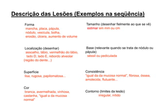 Forma
mancha, placa, pápula,
nódulo, vesícula, bolha,
erosão, úlcera, aumento de volume
Localização (desenhar)
assoalho, lábio, vermelhão do lábio,
lado D, lado E, rebordo alveolar
(região do dente...)
Superfície
lisa, rugosa, papilomatosa...
Cor
branca, avermelhada, vinhosa,
castanha, “igual a da mucosa
normal”
Descrição das Lesões (Exemplos na seqüência)
Tamanho (desenhar fielmente ao que se vê)
estimar em mm ou cm
Base (relevante quando se trata de nódulo ou
pápula)
séssil ou pediculada
Consistência
”igual da da mucosa normal”, fibrosa, óssea,
amolecida, flutuante...
Contorno (limites da lesão)
irregular, nítido
 