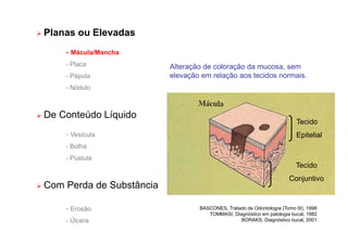 Planas ou Elevadas
- Mácula/Mancha
- Placa
- Pápula
- Nódulo
 De Conteúdo Líquido
- Vesícula
- Bolha
- Pústula
 Com Perda de Substância
- Erosão
- Úlcera
Alteração de coloração da mucosa, sem
elevação em relação aos tecidos normais.
BASCONES, Tratado de Odontología (Tomo III), 1998
TOMMASI, Diagnóstico em patologia bucal, 1982
BORAKS, Diagnóstico bucal, 2001
Tecido
Epitelial
Tecido
Conjuntivo
 
