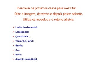 Descreva os próximos casos para exercitar.
Olhe a imagem, descreva e depois passe adiante.
Utilize os modelos e o roteiro abaixo:
• Lesão fundamental:
• Localização:
• Quantidade:
• Tamanho (mm):
• Borda:
• Cor:
• Base:
• Aspecto superficial:
 