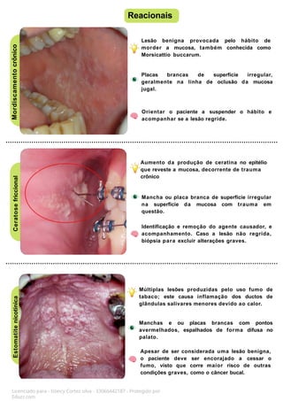 Mordiscamento
crônico
(morsicatio
buccarum)
Aumento da produção de ceratina no epitélio
que reveste a mucosa, decorrente de trauma
crônico
Mancha ou placa branca de superfície irregular
na superfície da mucosa com trauma em
questão.
Identificação e remoção do agente causador, e
acompanhamento. Caso a lesão não regrida,
biópsia para excluir alterações graves.
Ceratose
friccional
Estomatite
nicotínica Reacionais
Licenciado para - Isteicy Cortez silva - 33066442187 - Protegido por
Eduzz.com
Lesão benigna provocada pelo hábito de
morder a mucosa, também conhecida como
Morsicattio buccarum.
Placas brancas de superfície irregular,
geralmente na linha de oclusão da mucosa
jugal.
Orientar o paciente a suspender o hábito e
acompanhar se a lesão regride.
Múltiplas lesões produzidas pelo uso fumo de
tabaco; este causa inflamação dos ductos de
glândulas salivares menores devido ao calor.
Manchas e ou placas brancas com pontos
avermelhados, espalhados de forma difusa no
palato.
Apesar de ser considerada uma lesão benigna,
o paciente deve ser encorajado a cessar o
fumo, visto que corre maior risco de outras
condições graves, como o câncer bucal.
 