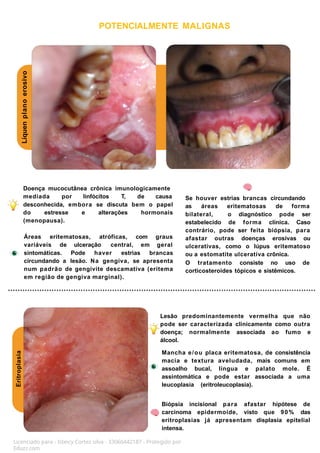 Eritroplasia
Líquen
plano
erosivo
Licenciado para - Isteicy Cortez silva - 33066442187 - Protegido por
Eduzz.com
POTENCIALMENTE MALIGNAS
Áreas eritematosas, atróficas, com graus
variáveis de ulceração central, em geral
sintomáticas. Pode haver estrias brancas
circundando a lesão. Na gengiva, se apresenta
num padrão de gengivite descamativa (eritema
em região de gengiva marginal).
Se houver estrias brancas circundando
as áreas eritematosas de forma
bilateral, o diagnóstico pode ser
estabelecido de forma clínica. Caso
contrário, pode ser feita biópsia, para
afastar outras doenças erosivas ou
ulcerativas, como o lúpus eritematoso
ou a estomatite ulcerativa crônica.
O tratamento consiste no uso de
corticosteroides tópicos e sistêmicos.
Lesão predominantemente vermelha que não
pode ser caracterizada clinicamente como outra
doença; normalmente associada ao fumo e
álcool.
Mancha e/ou placa eritematosa, de consistência
macia e textura aveludada, mais comuns em
assoalho bucal, língua e palato mole. É
assintomática e pode estar associada a uma
leucoplasia (eritroleucoplasia).
Biópsia incisional para afastar hipótese de
carcinoma epidermoide, visto que 90% das
eritroplasias já apresentam displasia epitelial
intensa.
Doença mucocutânea crônica imunologicamente
mediada por linfócitos T, de causa
desconhecida, embora se discuta bem o papel
do estresse e alterações hormonais
(menopausa).
 