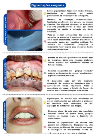 Tatuagem
por
amálg
a
ma Pigmentações exógenas
Lesões pigmentadas focais com limites definidos,
resultantes da deposição de metais
provenientes de restaurações de amálgama.
Manchas de coloração acinzentada/azul,
localizadas geralmente em gengiva ou mucosa
alveolar. Em algumas situações, o amálgama
não está presente devido a troca por resina
composta ou devido a extração do dente
envolvido.
Pode-se realizar radiografias das áreas de
tentativa de encontrar fragmentos radiolúcidos;
caso sejam encontrados, nenhum tratamento é
necessário, exceto por questões estéticas. Na
ausência de fragmentos radiopacos, é
importante fazer biópsia para descartar lesões
malignas melanocíticas.
Melanose
do
fumante
Pigm.
por
medicamentos
Excesso de melanina produzido na mucosa oral
de tabagistas como uma resposta protetora
contra algumas das substâncias nocivas no
fumo de tabaco.
Manchas enegrecidas em gengiva vestibular
anterior de fumantes de cigarro, semelhantes a
pigmentação racial melânica.
O diagnóstico pode ser feito mediante
correlação da história de tabagismo com a
apresentação clínica. Importante frisar a
necessidade de cessar o hábito de fumar, de
modo a evitar outras condições mais nocivas.
Pigmentações na mucosa oral decorrentes do
uso de medicamentos que estimulem a produção
de melanina pelos melanócitos, ou por
deposição de metabólitos das drogas.
Melanose difusa da pele e/ou das superfícies
mucosas, comum em palato, lábios, gengiva
inserida ou mucosa jugal, a depender do
medicamento.
Embora as pigmentações da mucosa oral
possam ser esteticamente desagradáveis, elas
não causam problemas. Na maioria dos casos,
a interrupção do medicamento resulta no
Licenciado para - Isteicy Cortez silva - 33066442187 - ProtegiddoespaorpEadruezcz.icmomento gradual das
 