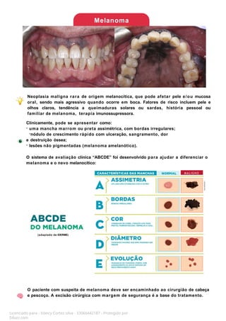 Melanoma
Neoplasia maligna rara de origem melanocítica, que pode afetar pele e/ou mucosa
oral, sendo mais agressivo quando ocorre em boca. Fatores de risco incluem pele e
olhos claros, tendência a queimaduras solares ou sardas, história pessoal ou
familiar de melanoma, terapia imunossupressora.
Clinicamente, pode se apresentar como:
- uma mancha marrom ou preta assimétrica, com bordas irregulares;
-nódulo de crescimento rápido com ulceração, sangramento, dor
e destruição óssea;
- lesões não pigmentadas (melanoma amelanótico).
O sistema de avaliação clínica “ABCDE” foi desenvolvido para ajudar a diferenciar o
melanoma e o nevo melanocítico:
O paciente com suspeita de melanoma deve ser encaminhado ao cirurgião de cabeça
e pescoço. A excisão cirúrgica com margem de segurança é a base do tratamento.
MALIGNO
Licenciado para - Isteicy Cortez silva - 33066442187 - Protegido por
Eduzz.com
(adaptado de IDERME)
 