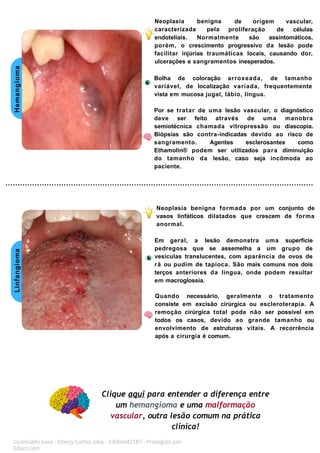 Hemangioma
Linfangioma
Neoplasia benigna
caracterizada pela proliferação
de origem vascular,
de células
endoteliais. Normalmente são assintomáticos,
porém, o crescimento progressivo da lesão pode
facilitar injúrias traumáticas locais, causando dor,
ulcerações e sangramentos inesperados.
Bolha de coloração arroxeada, de tamanho
variável, de localização variada, frequentemente
vista em mucosa jugal, lábio, língua.
Por se tratar de uma lesão vascular, o diagnóstico
deve ser feito através de uma manobra
semiotécnica chamada vitropressão ou diascopia.
Biópsias são contra-indicadas devido ao risco de
sangramento. Agentes esclerosantes como
Ethamolin® podem ser utilizados para diminuição
do tamanho da lesão, caso seja incômoda ao
paciente.
Neoplasia benigna formada por um conjunto de
vasos linfáticos dilatados que crescem de forma
anormal.
Em geral, a lesão demonstra uma superfície
pedregosa que se assemelha a um grupo de
vesículas translucentes, com aparência de ovos de
rã ou pudim de tapioca. São mais comuns nos dois
terços anteriores da língua, onde podem resultar
em macroglossia.
Quando necessário, geralmente o tratamento
consiste em excisão cirúrgica ou escleroterapia. A
remoção cirúrgica total pode não ser possível em
todos os casos, devido ao grande tamanho ou
envolvimento de estruturas vitais. A recorrência
após a cirurgia é comum.
Clique aqui para entender a diferença entre
um hemangioma e uma malformação
vascular, outra lesão comum na prática
clínica!
Licenciado para - Isteicy Cortez silva - 33066442187 - Protegido por
Eduzz.com
 