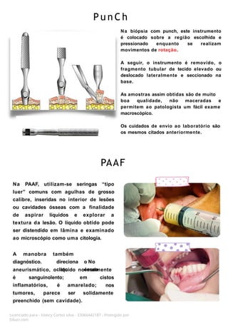 P u n C h
Licenciado para - Isteicy Cortez silva - 33066442187 - Protegido por
Eduzz.com
Na biópsia com punch, este instrumento
é colocado sobre a região escolhida e
pressionado enquanto se realizam
movimentos de rotação.
A seguir, o instrumento é removido, o
fragmento tubular de tecido elevado ou
deslocado lateralmente e seccionado na
base.
As amostras assim obtidas são de muito
boa qualidade, não maceradas e
permitem ao patologista um fácil exame
macroscópico.
Os cuidados de envio ao laboratório são
os mesmos citados anteriormente.
PAAF
Na PAAF, utilizam-se seringas “tipo
luer” comuns com agulhas de grosso
calibre, inseridas no interior de lesões
ou cavidades ósseas com a finalidade
de aspirar líquidos e explorar a
textura da lesão. O líquido obtido pode
ser distendido em lâmina e examinado
ao microscópio como uma citologia.
A manobra
diagnóstico.
também
direciona o No
cisto ósseo
aneurismático, o líquido normalmente
é sanguinolento; em
inflamatórios, é amarelado;
cistos
nos
tumores, parece ser solidamente
preenchido (sem cavidade).
 