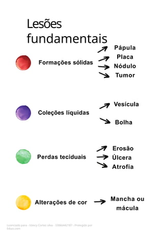 Lesões
fundamentais
Formações sólidas
Coleções líquidas
Perdas teciduais
Alterações de cor
Pápula
Placa
Nódulo
Tumor
Vesícula
Bolha
Erosão
Úlcera
Atrofia
Mancha ou
mácula
Licenciado para - Isteicy Cortez silva - 33066442187 - Protegido por
Eduzz.com
 