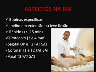 ASPECTOS NA RM
Bobinas específicas
Joelho em extensão ou leve flexão
Rápido (+/- 15 min)
Protocolo (3 e 4 mm)
- Sagital DP e T2 FAT SAT
- Coronal T1 e T2 FAT SAT
- Axial T2 FAT SAT
 