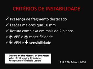 CRITÉRIOS DE INSTABILIDADE
 Presença de fragmento destacado
 Lesões maiores que 10 mm
 Rotura complexa em mais de 2 planos
 VPP e  especificidade
 VPN e  sensibilidade



                             AJR:176, March 2001
 