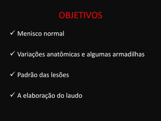 OBJETIVOS
 Menisco normal

 Variações anatômicas e algumas armadilhas

 Padrão das lesões

 A elaboração do laudo
 