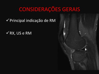 CONSIDERAÇÕES GERAIS
Principal indicação de RM

RX, US e RM
 