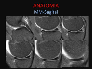 ANATOMIA
MM-Sagital
 