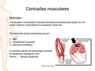 Contusões musculares Definição: A contusão é uma lesão muscular fechada produzida pela acção de um vector externo contundente ou actuando como tal. No momento inicial caracteriza-se por: 1 - Dor 2 - Impotência funcional 3 - Derrame hemático O controlo rápido da hemorragia permite  ao terapeuta assegurar uma  menor.....  fibrose cicatricial Hugo Pedrosa / 2009 