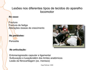 Lesões nos diferentes tipos de tecidos do aparelho locomotor No osso: Fractura Fractura de fadiga Alterações ósseas de crescimento No periósteo: Periostite Na articulação: Entorse/agressão capsular e ligamentar Subluxação e luxação/além dos limites anatómicos Lesão da fibrocartilagem (ex. menisco) Hugo Pedrosa / 2009 