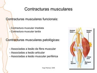 Contracturas musculares Contracturas musculares funcionais: - Contractura muscular imediata - Contractura muscular tardia Contracturas musculares patológicas: - Associadas a lesão da fibra muscular - Associadas a lesão articular - Associadas a lesão muscular periférica Hugo Pedrosa / 2009 