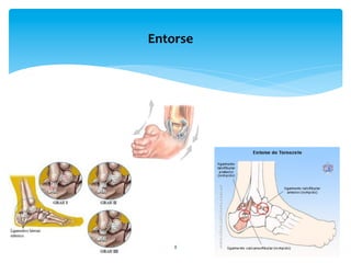 8	
  
Entorse	
  
 