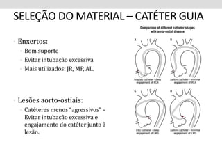 SELEÇÃO DO MATERIAL – CATÉTER GUIA 
• Enxertos: 
• Bom suporte 
• Evitar intubação excessiva 
• Mais utilizados: JR, MP, AL. 
• Lesões aorto-ostiais: 
• Catéteres menos “agressivos” – 
Evitar intubação excessiva e 
engajamento do catéter junto à 
lesão. 
 