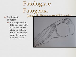 Patologia e
Patogenia
(Lesão do Bíceps com MR Lesado) Subluxação
superior:
 Rotura parcial ou
total dos ligg. GUS
e CU, anulando e
efeito de polia de
reflexão do bíceps
antes da entrada
no sulco ósseo.
 