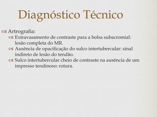 Diagnóstico Técnico
 Artrografia:
 Extravasamento de contraste para a bolsa subacromial:
lesão completa do MR.
 Ausência de opacificação do sulco intertubercular: sinal
indireto de lesão do tendão.
 Sulco intertubercular cheio de contraste na ausência de um
impresso tendinoso: rotura.
 