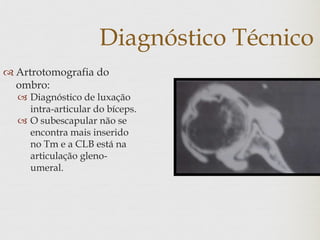 Diagnóstico Técnico
 Artrotomografia do
ombro:
 Diagnóstico de luxação
intra-articular do bíceps.
 O subescapular não se
encontra mais inserido
no Tm e a CLB está na
articulação gleno-
umeral.
 