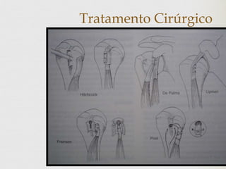 Tratamento Cirúrgico
 