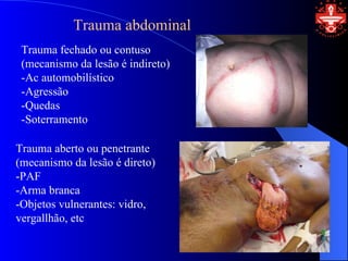 Trauma abdominal
 Trauma fechado ou contuso
 (mecanismo da lesão é indireto)
 -Ac automobilístico
 -Agressão
 -Quedas
 -Soterramento

Trauma aberto ou penetrante
(mecanismo da lesão é direto)
-PAF
-Arma branca
-Objetos vulnerantes: vidro,
vergallhão, etc
 