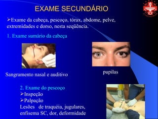 EXAME SECUNDÁRIO
Exame da cabeça, pescoço, tórax, abdome, pelve,
extremidades e dorso, nesta seqüência.
1. Exame sumário da cabeça




Sangramento nasal e auditivo              pupilas


      2. Exame do pescoço
      Inspeção
      Palpação
      Lesões de traquéia, jugulares,
      enfisema SC, dor, deformidade
 