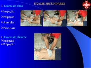 EXAME SECUNDÁRIO
3. Exame do tórax
Inspeção
Palpação
Ausculta
Percussão


4. Exame do abdome
Inspeção
Palpação
 