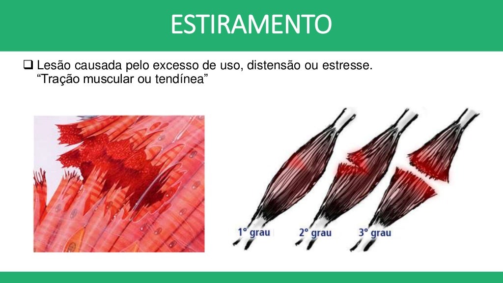 Tableau abstrait main image 0