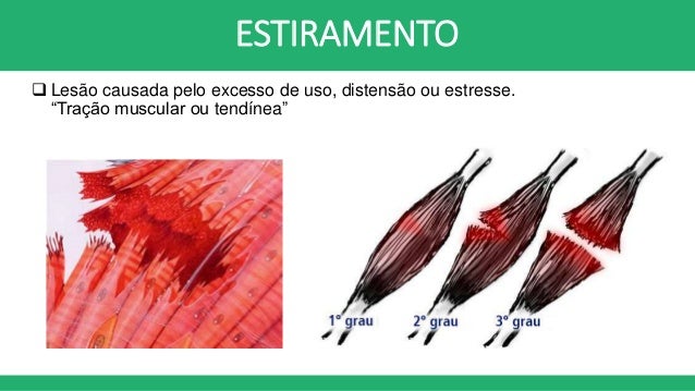 Image Result For Espasmo Muscular Image Result For Espasmo Muscular