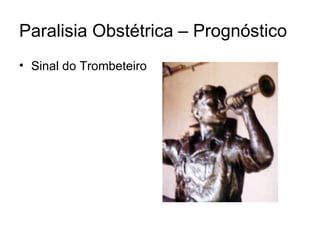 Paralisia Obstétrica – Prognóstico Sinal do Trombeteiro 