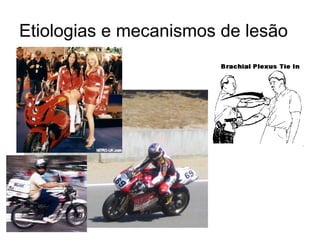 Etiologias e mecanismos de lesão 