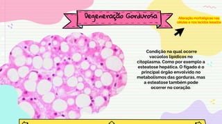 Condição na qual ocorre
vacúolos lipídicos no
citoplasma. Como por exemplo a
esteatose hepática. O fígado é o
principal órgão envolvido no
metabolismos das gorduras, mas
a esteatose também pode
ocorrer no coração.
Degeneração Gordurosa Alteração morfológicas nas
células e nos tecidos lesados
 