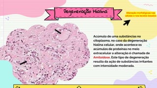 Acúmulo de uma substâncias no
citoplasma, no caso da degeneração
hialina celular, onde acontece os
acúmulos de proteínas no meio
extracelular a alteração é chamada de
Amiloidose. Este tipo de degeneração
resulta da ação de substâncias irritantes
com intensidade moderada.
Degeneração Hialina Alteração morfológicas nas
células e nos tecidos lesados
 