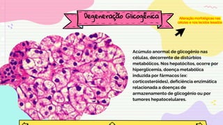 Acúmulo anormal de glicogênio nas
células, decorrente de distúrbios
metabólicos. Nos hepatócitos, ocorre por
hiperglicemia, doença metabólica
induzida por fármacos (ex:
corticosteróides), deficiência enzimática
relacionada a doenças de
armazenamento de glicogênio ou por
tumores hepatocelulares.
Degeneração Glicogênica Alteração morfológicas nas
células e nos tecidos lesados
 