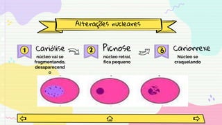 Alterações nucleares
Cariólise
núcleo vai se
fragmentando,
desaparecend
o
Picnose
núcleo retraí,
fica pequeno
Cariorrexe
Núcleo se
craquelando
 
