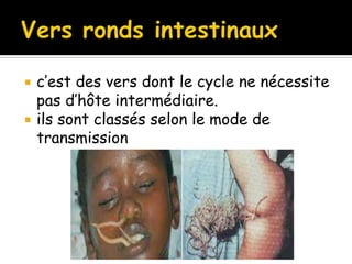  c’est des vers dont le cycle ne nécessite
pas d’hôte intermédiaire.
 ils sont classés selon le mode de
transmission
 