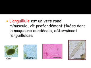  L’anguillule est un vers rond
minuscule, vit profondément fixées dans
la muqueuse duodénale, déterminant
l’anguillulose
Oeuf Œuf+L1
L1
L3
 