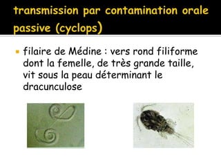  filaire de Médine : vers rond filiforme
dont la femelle, de très grande taille,
vit sous la peau déterminant le
dracunculose
 