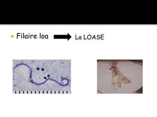  Filaire loa La LOASE
 