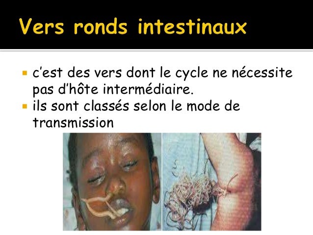 Neoumyvakin sur les parasites dans lorganisme de la personne