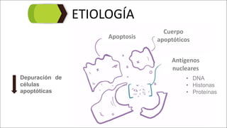 ETIOLOGÍA
Cuerpo	
apoptóticosApoptosis
Antígenos	
nucleares
• DNA
• Histonas
• Proteínas
Depuración de
células
apoptóticas
 