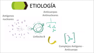 ETIOLOGÍA
Antígenos	
nucleares
Linfocito	B
Anticuerpos	
Antinucleares
Complejos	Antígeno	-
Anticuerpo
 