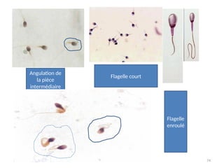 24/01/2025 74
Angulation de
la pièce
intermédiaire
Flagelle court
Flagelle
enroulé
 