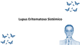 Lupus Eritematoso Sistémico
16 Febrero 2022
Monterrey, NL.
 