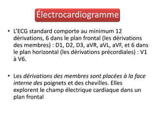 Électrocardiogramme
• L’ECG standard comporte au minimum 12
  dérivations, 6 dans le plan frontal (les dérivations
  des membres) : D1, D2, D3, aVR, aVL, aVF, et 6 dans
  le plan horizontal (les dérivations précordiales) : V1
  à V6.

• Les dérivations des membres sont placées à la face
  interne des poignets et des chevilles. Elles
  explorent le champ électrique cardiaque dans un
  plan frontal
 