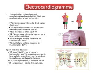 Électrocardiogramme
•     Les dérivations précordiales sont
     unipolaires et explorent l’activité électrique
     cardiaque dans le plan horizontal. :

     • V1 : 4ème espace intercostal droit, au ras
      du sternum
     • V2 : symétrique par rapport au sternum
      (4ème espace intercostal gauche)
    • V3 : à mi-distance entre V2 et V4
    • V4 : 5ème espace intercostal gauche, sur la
      ligne médio-claviculaire
    • V5 : sur la ligne axillaire antérieure à «
      l’horizontale » de V4
    • V6 : sur la ligne axillaire moyenne à «
      l’horizontale » de V4.

Il peut être utile d’ajouter :
    • V7, voire V8 et V9 : sur la même «
      horizontale » que V4, respectivement sur la
      ligne axillaire postérieure, sous la pointe de
      l’omoplate, au bord gauche du rachis
   • V3R, V4R : symétriques, à droite de V3-V4
   • VE (épigastrique) : pointe de la xiphoïde.
 