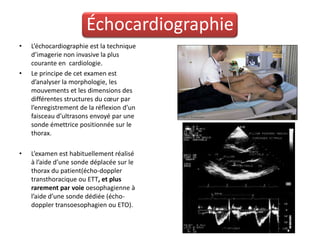 Échocardiographie
•   L’échocardiographie est la technique
    d’imagerie non invasive la plus
    courante en cardiologie.
•   Le principe de cet examen est
    d’analyser la morphologie, les
    mouvements et les dimensions des
    différentes structures du cœur par
    l’enregistrement de la réflexion d’un
    faisceau d’ultrasons envoyé par une
    sonde émettrice positionnée sur le
    thorax.

•   L’examen est habituellement réalisé
    à l’aide d’une sonde déplacée sur le
    thorax du patient(écho-doppler
    transthoracique ou ETT, et plus
    rarement par voie oesophagienne à
    l’aide d’une sonde dédiée (écho-
    doppler transoesophagien ou ETO).
 
