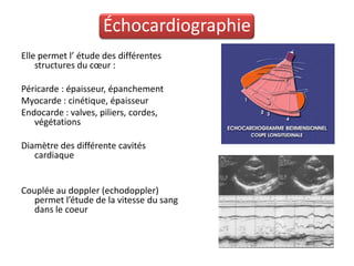Échocardiographie
Elle permet l’ étude des différentes
    structures du cœur :

Péricarde : épaisseur, épanchement
Myocarde : cinétique, épaisseur
Endocarde : valves, piliers, cordes,
   végétations

Diamètre des différente cavités
   cardiaque


Couplée au doppler (echodoppler)
   permet l’étude de la vitesse du sang
   dans le coeur
 