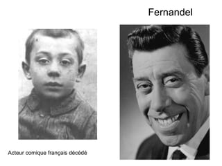 Fernandel Acteur comique français décédé 